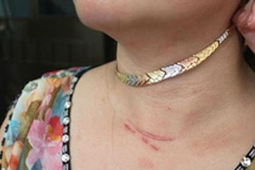 Bắt kẻ mang roi điện đi cướp dây chuyền nữ của chủ quán cà phê