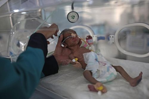 Vì Covid-19, 10.000 trẻ em đang chết mỗi tháng dù không nhiễm virus