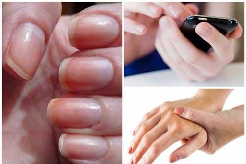 Nhìn vào ngón tay thấy có dấu hiệu này hãy nghĩ ngay tới căn bệnh nguy hiểm, đề phòng không thừa