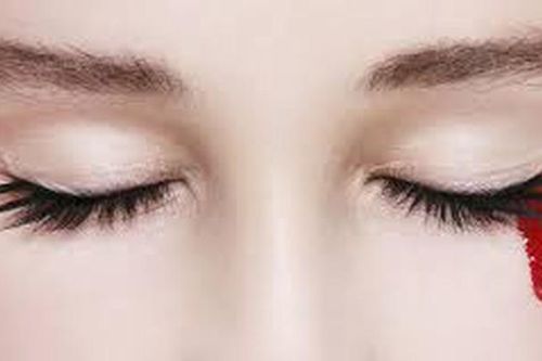 Giải mã bí ẩn những người khóc ra máu