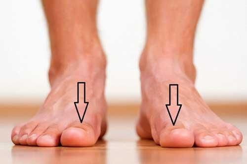Bàn chân xuất hiện cùng lúc 3 dấu hiệu này: Cảnh báo thận đang 'kêu cứu' gấp, hãy đi kiểm tra ngay
