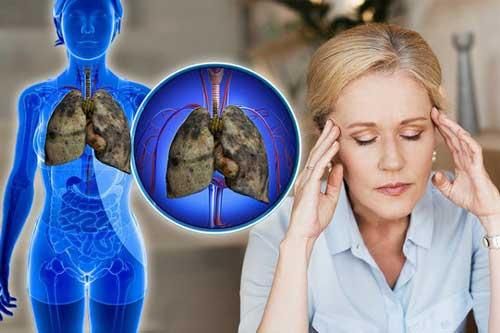 Tín hiệu cảnh báo ung thư phổi đang tấn công cơ thể, chớ dại mà coi thường