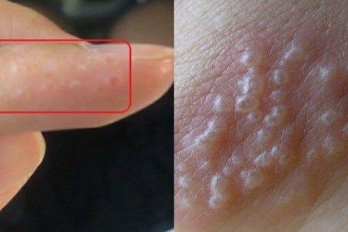 Nếu phát hiện tay có dấu hiệu này, cần đi khám ngay lập tức