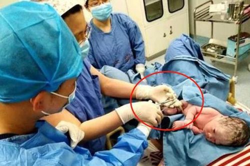 Tại sao khi cắt dây rốn em bé khóc rất to còn mẹ không có cảm giác gì?