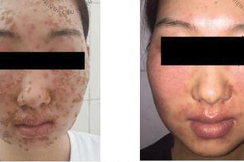 Làm đẹp trên mạng (online), hệ lụy khôn lường
