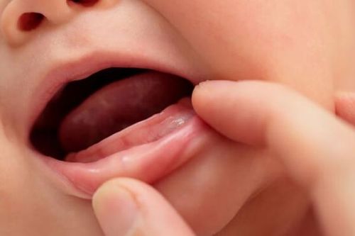 Dấu hiệu trẻ đi tướt mọc răng