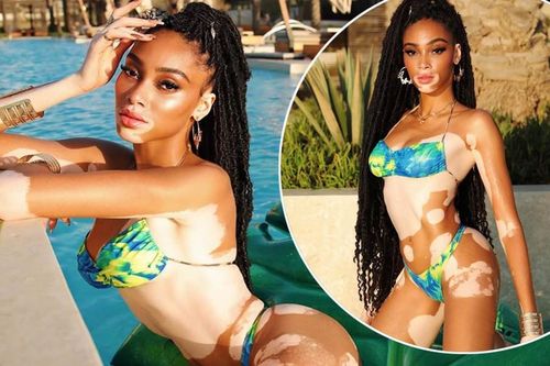 Winnie Harlow thả dáng chuẩn như tạc tượng