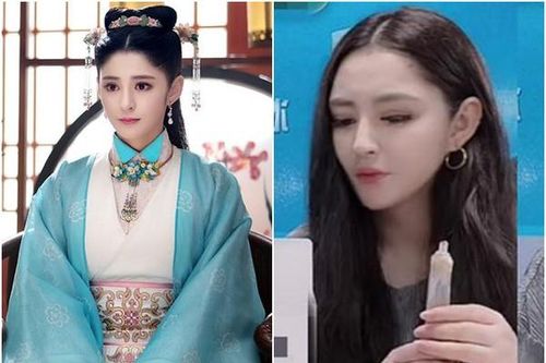 Bông hồng lai hay kẻ lắm lời của Cbiz gặp biến chứng đáng sợ vì 'dao kéo'