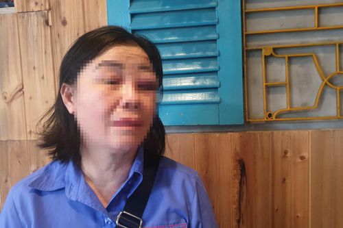 Người đàn ông đánh nữ tiếp viên xe buýt sưng mắt vì bị nhắc nhở mở nhỏ nhạc