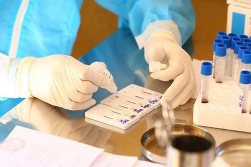 TP.HCM: 8 bệnh viện có đủ năng lực xét nghiệm khẳng định virus SARS-CoV-2