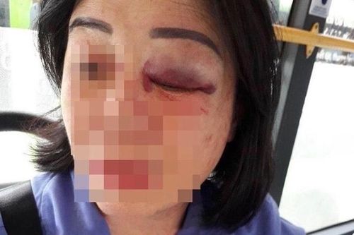 Điều tra vụ nữ nhân viên bị khách hành hung trên xe buýt