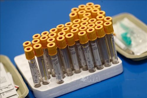 Xác định được protein là chỉ dấu sớm đối với bệnh nhân nặng mắc COVID-19