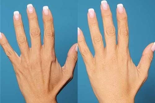 Cách cải thiện và trẻ hóa làm da tay nhăn nheo mà các chị em nên tham khảo