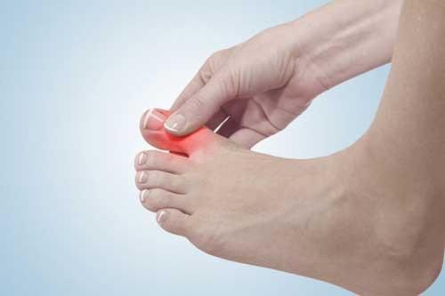 10 dấu hiệu trên bàn chân tưởng chừng 'vô hại' nhưng lại cảnh báo vấn đề nghiêm trọng về sức khỏe, cần đi khám ngay