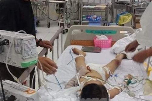 Xác định nguyên nhân bé 7 tuổi tử vong sau khi tháo đinh nẹp tay