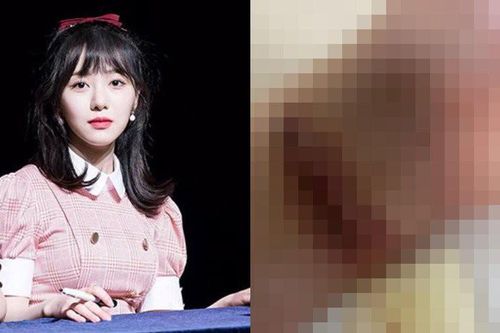 Nữ idol Hàn Quốc rạch tay tự tử gây sốc, bất ngờ nhắc đến Sulli