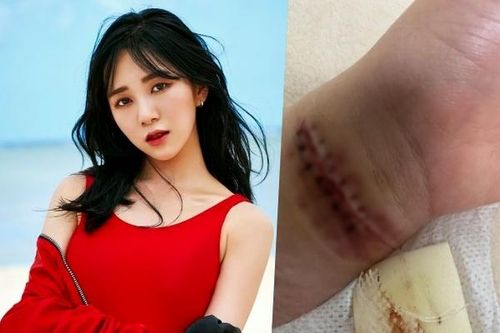 Cựu thành viên AOA rạch tay tự sát, cảnh báo công ty quản lý cũ