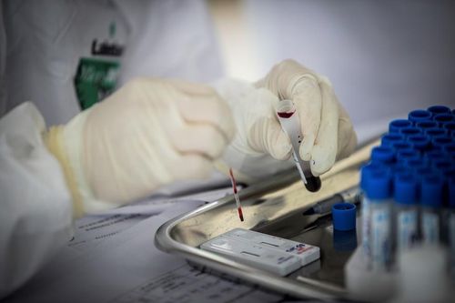 Test nhanh COVID-19 âm tính, xét nghiệm lại dương tính: Sở Y tế Hà Nội nói gì?