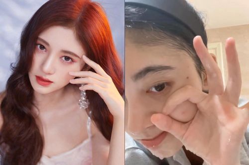 Cúc Tịnh Y bị nghi thẩm mỹ mũi