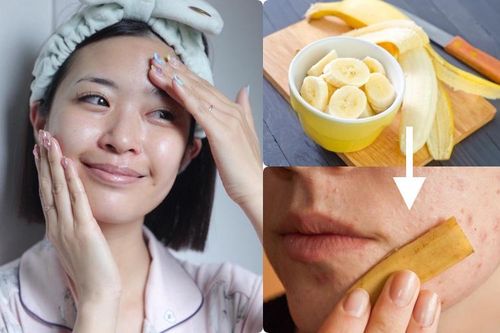Không cần mỹ phẩm đắt tiền, miếng vỏ chuối bạn vứt đi lại là 'thần dược' chống lão hóa, diệt mụn nhọt, vết nám