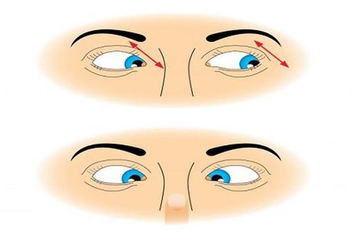 3 bài tập yoga dành cho người hay bị mỏi mắt, mờ mắt