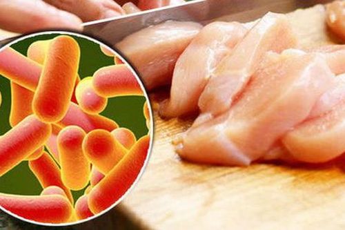 Rối loạn tiêu hóa thường gặp trong mùa hè: Cách xử trí và phòng ngừa