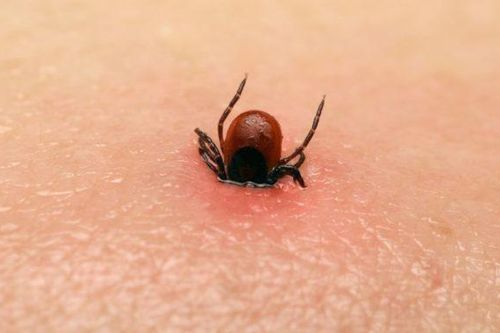 'Virus tử thần' mới xuất hiện ở Trung Quốc sẽ lây lan như thế nào?