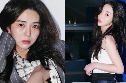 Cựu thành viên AOA Kwon Mina xuất viện, chưa có kế hoạch hoạt động trong thời gian sắp tới