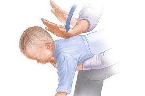Cảnh báo hóc dị vật do ăn hoa quả ở trẻ
