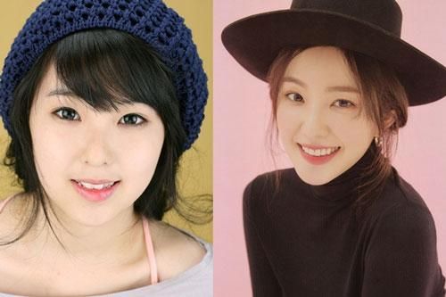 Những visual Kpop từng bị nghi phẫu thuật thẩm mỹ