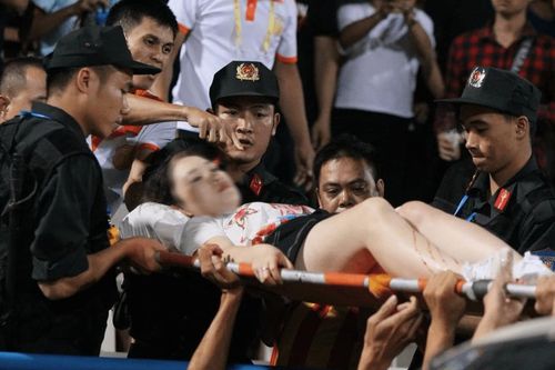 CLB Nam Định kêu gọi quyên góp cho người bắn pháo gây thương tích