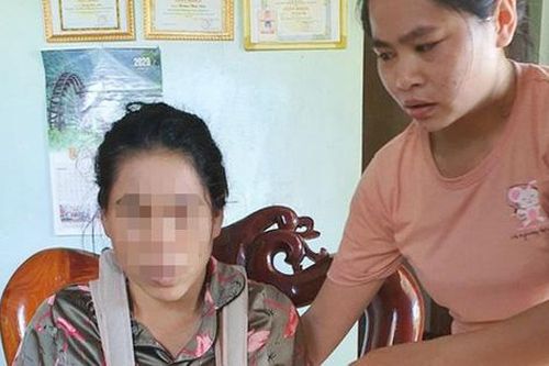 Hội LHPN Quảng Bình đề nghị điều tra làm rõ vụ một phụ nữ bị chồng bạo hành ở xã Tây Trạch