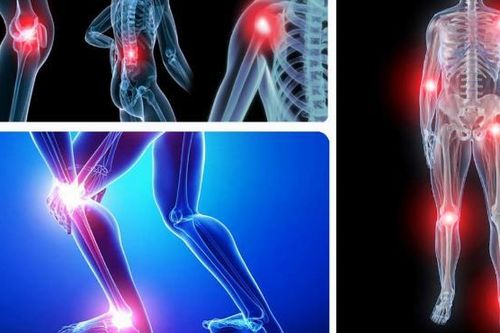 Giải pháp thảo dược cho bệnh xương khớp thường gặp ở người cao tuổi