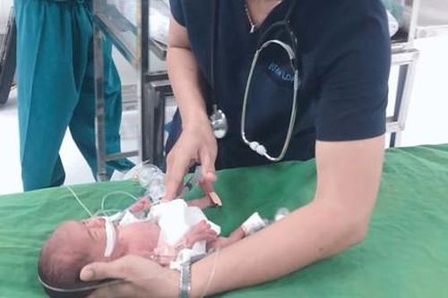Cứu sống bé gái nặng 0,8kg bị thủng tạng