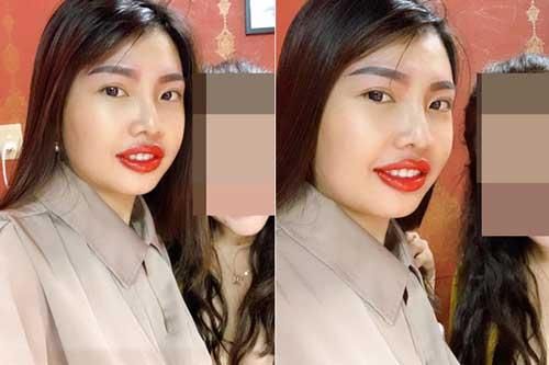 Phượng 'Thị Nở' gây thất vọng với đôi môi 'kém duyên' sau khi đi làm đẹp