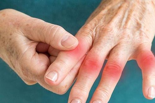 Hỗ trợ chữa phong thấp ở người cao tuổi bằng cây thuốc dễ kiếm