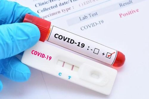 Đi xét nghiệm COVID-19 xong lại đi ăn uống khắp thành phố, về nhà thì nhận tin dương tính