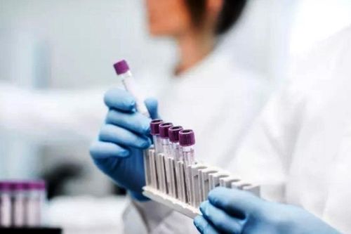 FDA cấp phép xét nghiệm Covid-19 mới từ mẫu nước bọt