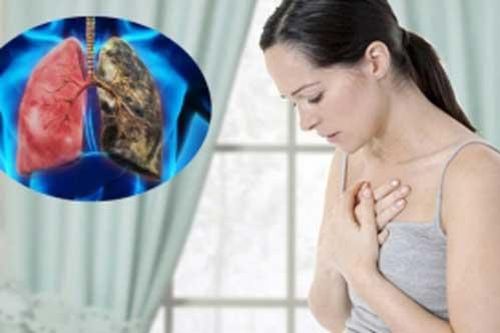 5 tín hiệu 'cầu cứu' của phổi, cần đi kiểm tra càng sớm càng tốt