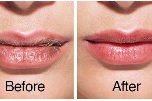 6 cách biến đôi môi bong tróc thành căng mọng, mịn màng