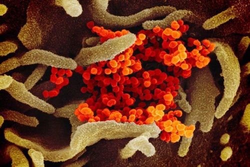 Biến thể D614G của virus SARS-CoV-2 ít gây tử vong