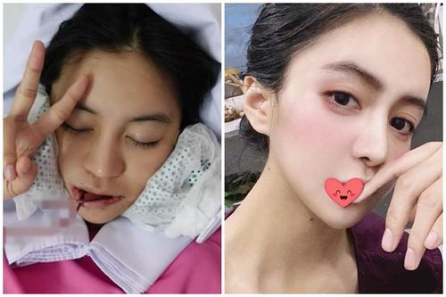 Đăng clip băng mặt, hot girl Hải Phòng thừa nhận động 'dao kéo'
