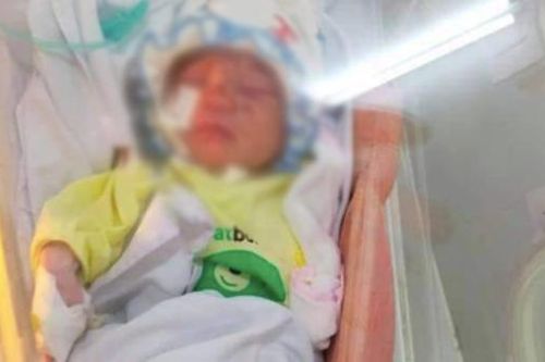 Tình trạng bé sơ sinh bị bỏ rơi giữa khe tường: Trên người nhiều vết thương, không phải thở máy
