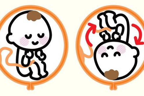 Làm được việc này khi mang bầu, mẹ sẽ không lo thai nhi ngôi ngược