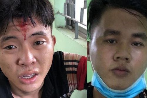 Cảnh sát hình sự bị đâm khi bắt trộm ở TP.HCM