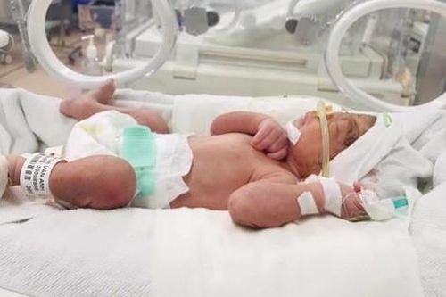Sản phụ sinh con khỏe mạnh dù đã vỡ tử cung ở tuần 25 và những kỳ tích tưởng như 'khó có thể xảy ra'