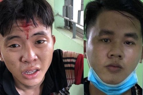 Trộm xe máy còn rút dao đâm công an