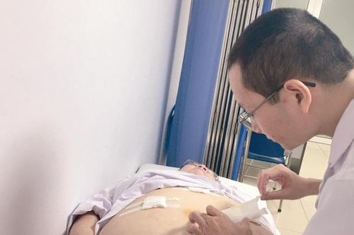 Đặt vòng thắt dạ dày bằng nội soi để... giảm béo