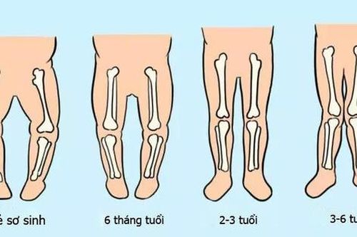5 dấu hiệu cho thấy trẻ sơ sinh sau này sẽ cao lớn
