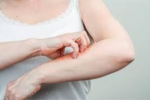 Phát hiện ca mắc dịch hạch tại Mỹ